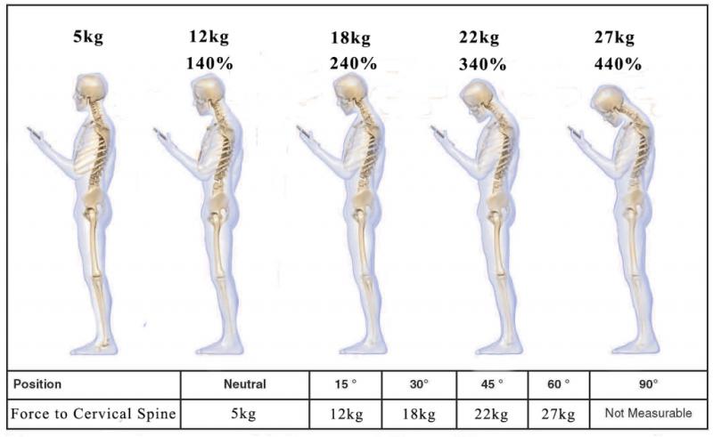 Boyun Fıtığı Tansiyonu Yükseltir mi?